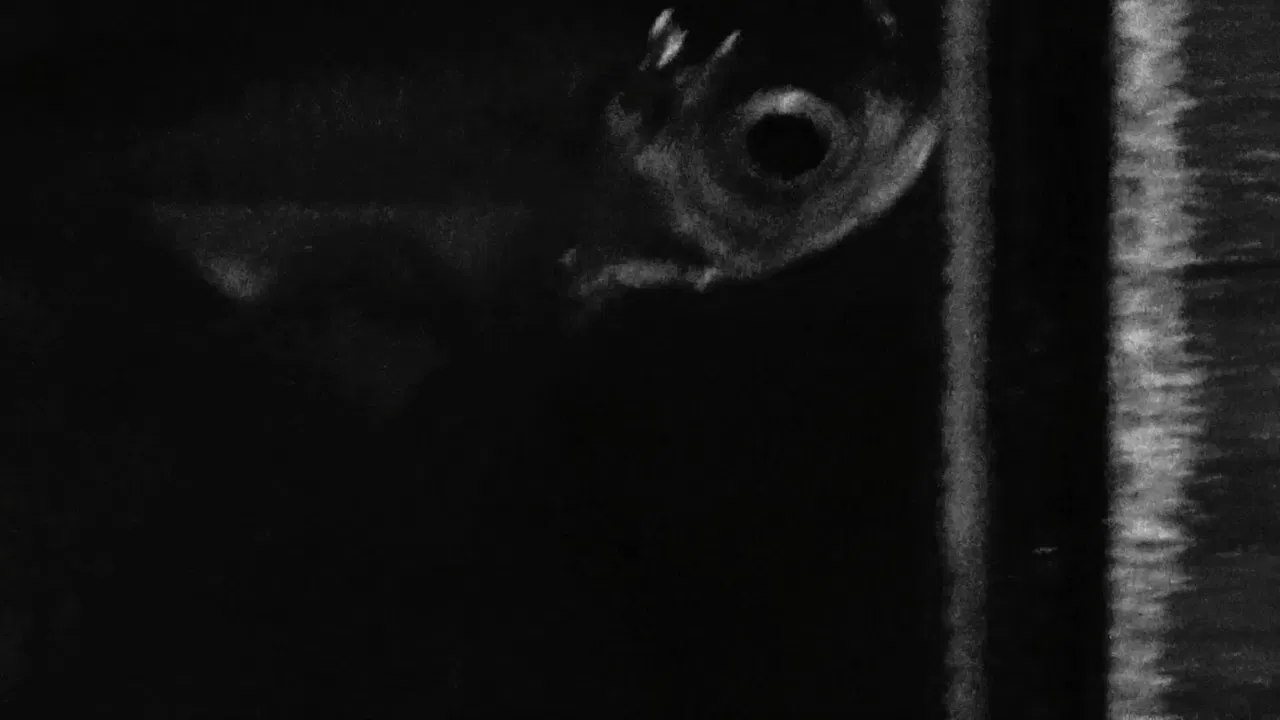 Anomalies (Fibrosis) backdrop