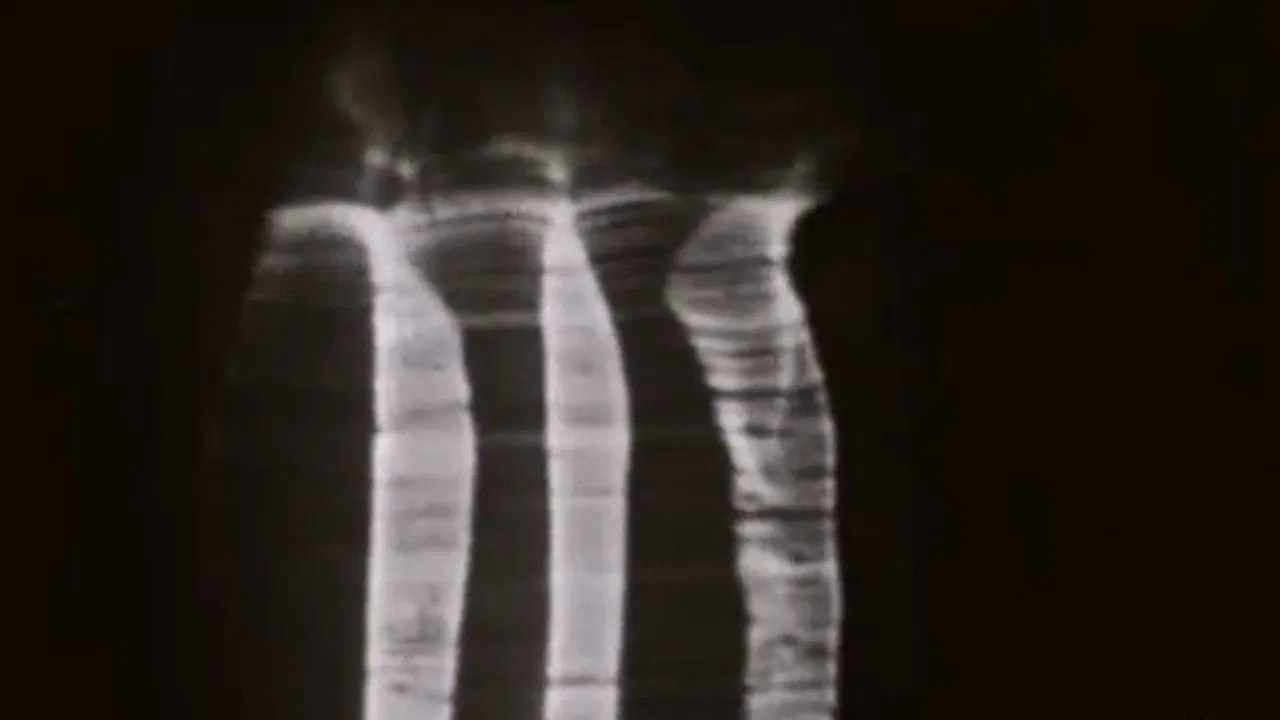 The Achalunés backdrop