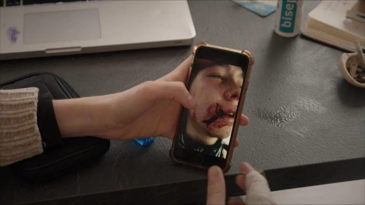 Ma blessure d'âge adulte backdrop