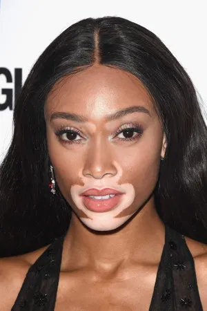 Winnie Harlow photo