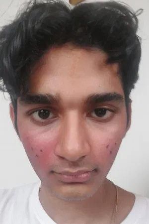 Cyril Abraham Dennis photo