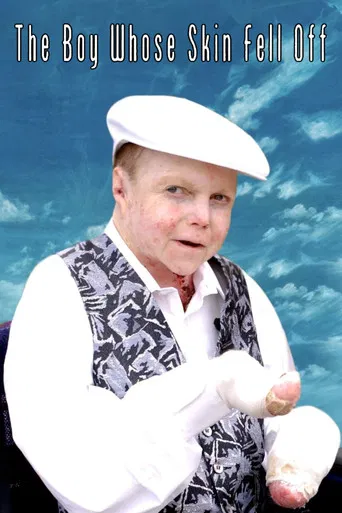 The Boy Whose Skin Fell Off poster