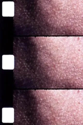 Carotid Artery poster