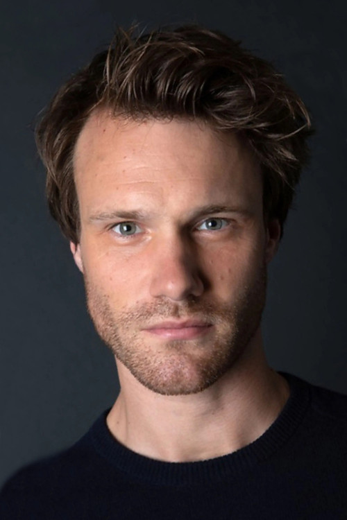 Hugh Skinner profile