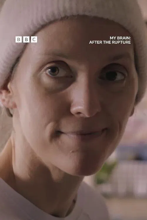 My Brain: After the Rupture poster