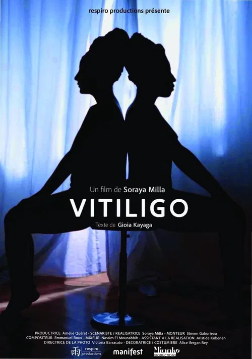 Vitiligo poster