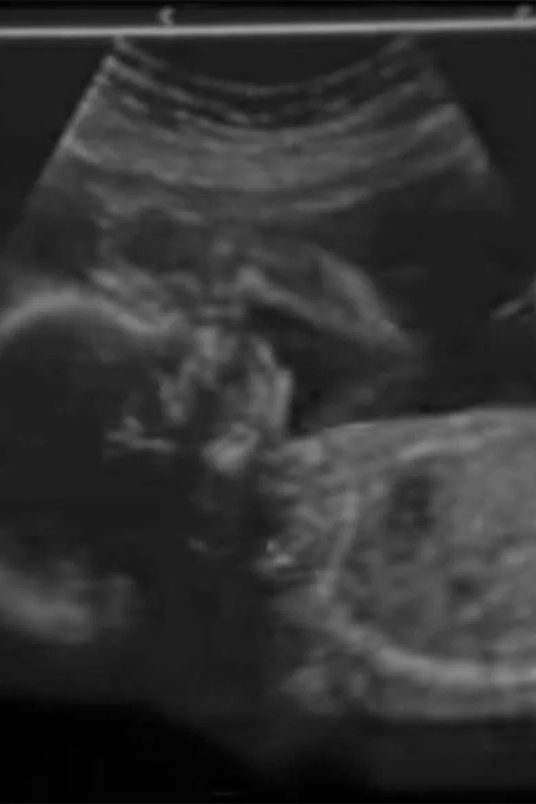 Con el corazón poster background